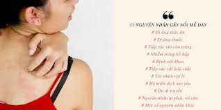 Nguyên nhân phổ biến liên quan đến thời tiết gây dị ứng