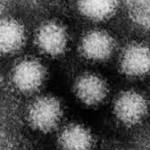  Over 50 People Sickened by Norovirus Outbreak at Vermont Restaurant