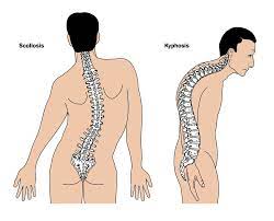 She is the backbone of the family. Thoracic Spine