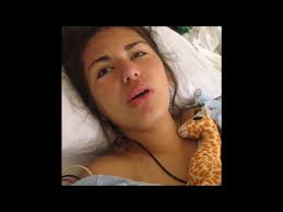 Grace is a young giraffe with scoliosis and is the main character in june's new book, being grace. Scoliosis Surgery Video Youtube