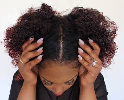 Get fresh aloe vera gel and then apply it directly on it. How To Relieve A Itchy Dry Dandruff Scalp For Natural Hair Chocojuliet