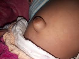 pediatric surgery hospital posts facebook