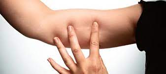 Once it expires, it no longer protects against pregnancy. Birth Control Implants At The Manhattan Center For Gynecology