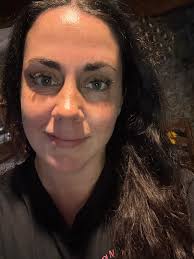 This is my dear, amazingly beautiful friend Julie. This is her results  after 2 months of using our skin care products. You can see the redness is  disappearing, her age spots have