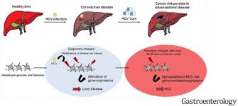 May 27, 2021 · chiao ey, engels ea, kramer jr, pietz k, henderson l, giordano tp, et al. Hcv Induced Epigenetic Changes Associated With Liver Cancer Risk Persist After Sustained Virologic Response Gastroenterology