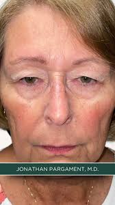 Jon Pargament, MD