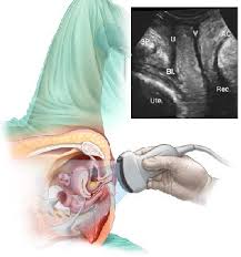 Watch this and know what to expect before your appointment. Transperineal Pelvic Floor Ultrasound Scan Your Pelvic Floor