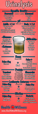 They are painless, easy, quick, and cost. Urinalysis Ua Interpretation Medical Laboratory Science Medical Laboratory Medical Professionals