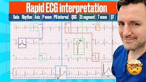 Image result for Electrocardiogram