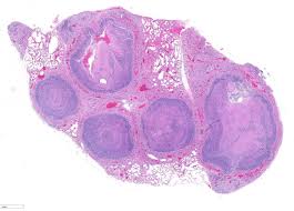 Image result for Rhodococcus equi