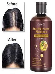 Grow me® hair growth shampoo, sulphate free, vegan, caffeine, biotin, argan oil, allantoin, rosemary. Amazon Com Hair Growth Shampoo Hair Loss Shampoo Hair Thickening Shampoo Helps Stop Hair Loss Grow Hair Fast Hair Loss Treatment For Men Women 220ml Beauty Personal Care