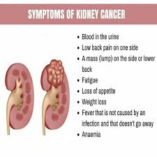 Pin On Kidney Related