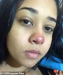 You are best advised to keep your face bare for about a week after you get your nose pierced. Woman 20 Left In Wheelchair For Life After Getting Nose Pierced And Suffering Bacterial Infection Daily Mail Online