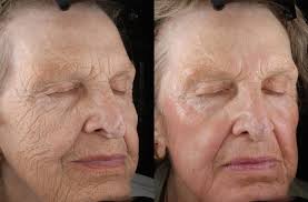 We're located in delray beach and . Skin Treatments Medical Spa And Laser Center Chelsea Mi Chelsea Laser Aesthetics