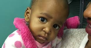 Live from Swaziland ... it's Saturday morning!: 18-month-old baby girl is  the size of a 5-month-old