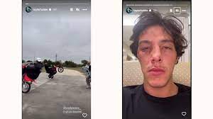 What happened to Tayler Holder? Influencer sustains broken nose, shoulder,  and ribs during Texas visit