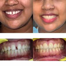 👋 Mr Arjun Kishore CEO & Director of Apex 🏥Apex indian Speciality  Hospital 📍 Summit in front of federal high court 📞call +251949001133  #indiandoctors #doctor #healthy #ethiopian_tik_tok🇪🇹🇪🇹🇪🇹🇪🇹  #surgoendoctor🏥🥼💉 #hospital #indianhospital