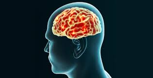 Thu, aug 5, 2021, 4:00pm edt Huntington S Disease Lehigh Valley Health Network