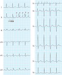 看護roo!（カンゴルー）