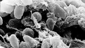 Virus corona yang terus bermutasi kini banyak menyerang kalangan muda dan menyebabkan keparahan. Mutasi Virus Corona Bikin Covid 19 Melemah Benarkah