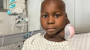 Tübinger Ärzte retten todkranken, fünfjährigen Tumorpatienten