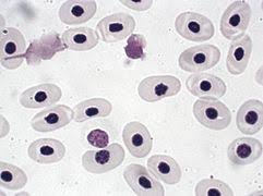 Lo striscio viene essiccato, fissato e colorato, con appositi coloranti, per poi essere osservato al microscopio ottico. Sangue Wikipedia