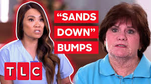Dr. Lee “Sands Down” A Woman’s Bumps On Her Skin