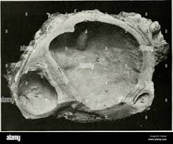 Image result for phlegmon on face)