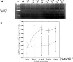 Domnilor, oug57, art 40 are o mare problema, este ilegal si cred ca acum au aflat si ei. Anti Apolipoprotein A 1 Igg Predicts Major Cardiovascular Events In Patients With Rheumatoid Arthritis Vuilleumier 2010 Arthritis Amp Rheumatism Wiley Online Library