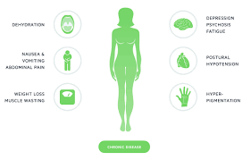 Proponents of the adrenal fatigue diagnosis claim this is a mild form of adrenal insufficiency caused by chronic. Pulsenotes Addison S Disease Notes