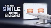 AI Orthodontic Treatment Simulation | Waldent IntraVue 900 | DentalKart