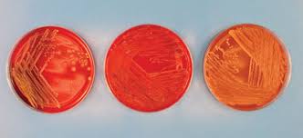 Image result for Rhodococcus equi