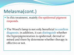 Woods Light In Dermatology