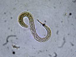 Image result for Strongyloides