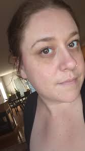 Blemish coverage with Gy1 or Yo1 for red and purple