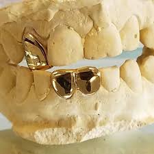 Places near atlanta, ga with flea markets with same day gold grills. Pin On Bossladygrillz House Of Gold Teeth And Snap On Smiles