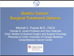 They can affect your digestion, such as: Gastric Cancer Surgical Treatment Options Youtube