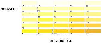 10 Signalen En Symptomen Van Uitdroging Yorbody Fysiotherapie