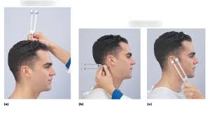 Image result for Tuning Fork Test