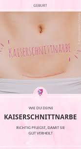 Wieviel sport kann man nach einem kaiserschnitt machen? Die Kaiserschnittnarbe Richtig Pflegen Babyartikel De Magazin
