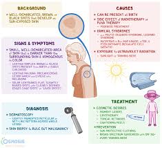 Image result for Solar Lentigo