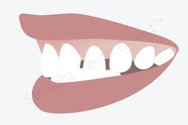 Teeth gaps can be fixed with different dental techniques. Teeth Gaps Can They Be Closed Without The Use Of Braces