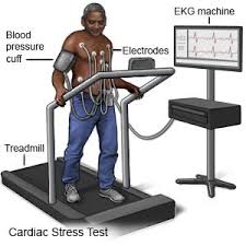 Image result for Exercise Stress Test