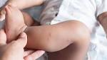  This popular medicine may prevent a severe disease's relapse