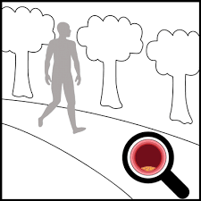 Pavk Symptome Stadien Risikofaktoren Ratgeber Cholesterin