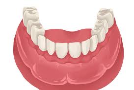 Do i need to get my wisdom teeth out? Complete Dentures Full Removable Cost Set Costa Mesa Ca California Dentistry At Its Finest