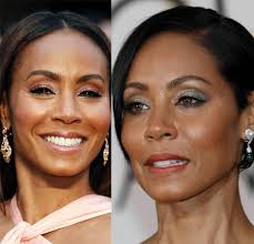 Jada Pinkett Smith Plastic Surgery Before And After Plastic Surgery Celebrity Plastic Surgery Face Lift Surgery