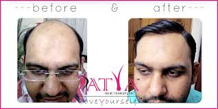 Pin On Satya Hair Clinic