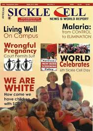 Yes White People Have Sickle Cell Sickle Cell Sickle Cell Disease Sickle Cell Awareness