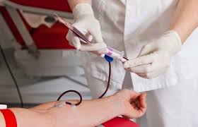 Afețiunea de herpes oral sau hpv este o infectie a gurii și a buzelor cauzată de virusul herpex simplex (hsv). 159 De Buzoieni InfectaÅ£i Cu Hiv Opinia BuzÄu